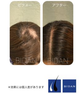 【BIDAN】奈良店｜口コミ・評判