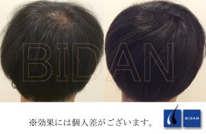 【BIDAN】堺東店｜口コミ・評判（レディース）