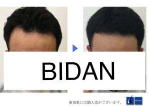 【BIDAN】梅田店｜口コミ・評判（メンズ）